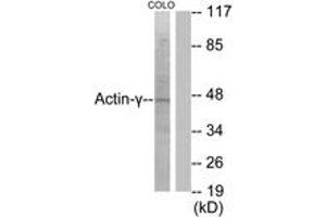 Western Blotting (WB) image for anti-Actin, gamma 2, Smooth Muscle, Enteric (ACTG2) (AA 1-50) antibody (ABIN1533207)