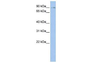 WB Suggested Anti-BMP2K Antibody Titration:  0. (BMP2K 抗体  (Middle Region))