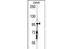 SG1 Antibody (N-term) (ABIN651886 and ABIN2840439) western blot analysis in Jurkat cell line lysates (35 μg/lane). (SPAG1 抗体  (N-Term))