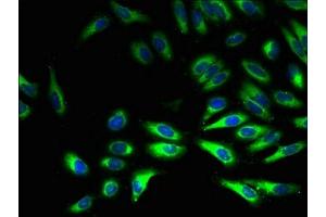 Immunofluorescent analysis of Hela cells using ABIN7160982 at dilution of 1:100 and Alexa Fluor 488-congugated AffiniPure Goat Anti-Rabbit IgG(H+L) (CYB5R3 抗体  (AA 1-301))