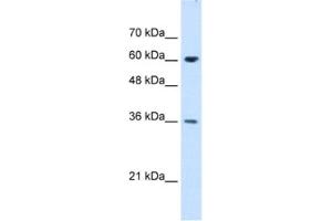 Western Blotting (WB) image for anti-Stress-Induced-phosphoprotein 1 (STIP1) antibody (ABIN2462950) (STIP1 抗体)