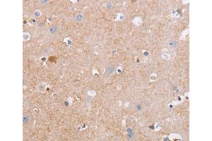 Immunohistochemistry (IHC) image for anti-Cell Division Cycle 7 (CDC7) antibody (ABIN2434442) (CDC7 抗体)