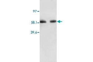 Western Blot analysis of RELA expression from human colon carcinoma lyate with RELA polyclonal antibody . (NF-kB p65 抗体  (N-Term))