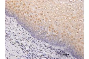 Immunoperoxidase of monoclonal antibody to PIM1 on formalin-fixed paraffin-embedded human esophagus. (PIM1 抗体  (AA 1-313))