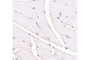Immunohistochemistry (Paraffin-embedded Sections) (IHC (p)) image for anti-Fast Skeletal Troponin I (TNNI2) antibody (ABIN7076031)