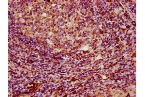 IHC image of ABIN7163751 diluted at 1:100 and staining in paraffin-embedded human tonsil tissue performed on a Leica BondTM system. (PARP3 抗体  (AA 1-240))