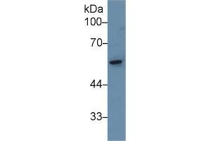 Western Blot; Sample: Rat Small intestine lysate; Primary Ab: 1µg/ml Rabbit Anti-Rat KRT8 Antibody Second Ab: 0. (CAP1 抗体  (AA 38-149))