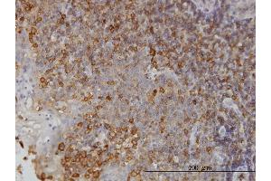 Immunoperoxidase of monoclonal antibody to NMI on formalin-fixed paraffin-embedded human tonsil.