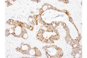 Immunohistochemistry (IHC) image for anti-Dihydrolipoamide S-Succinyltransferase (E2 Component of 2-Oxo-Glutarate Complex) (DLST) (AA 50-100) antibody (ABIN7455019) (DLST 抗体  (AA 50-100))