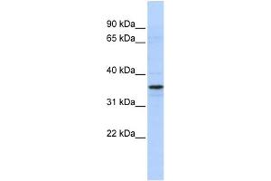 WB Suggested Anti-TADA2L Antibody Titration:  0.