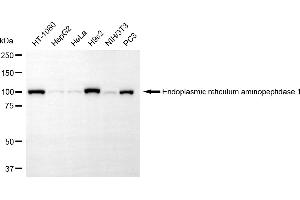 anti-Endoplasmic Reticulum Aminopeptidase 1 (ERAP1) antibody