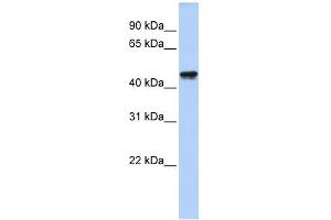 QTRTD1 antibody used at 1 ug/ml to detect target protein. (QTRTD1 抗体  (N-Term))
