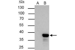IP Image XLF antibody [N3C3] immunoprecipitates XLF protein in IP experiments.