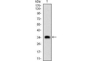 Fig. (CSNK2B 抗体  (AA 1-215))