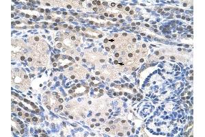 PAIP1 antibody was used for immunohistochemistry at a concentration of 4-8 ug/ml to stain Epithelial cells of renal tubule (arrows) in Human Kidney.