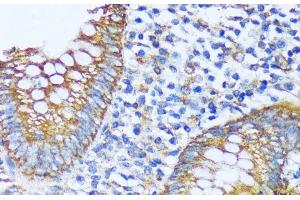 Immunohistochemistry of paraffin-embedded Human appendix using ACOT2 Polyclonal Antibody at dilution of 1:100 (40x lens). (ACOT2 抗体)
