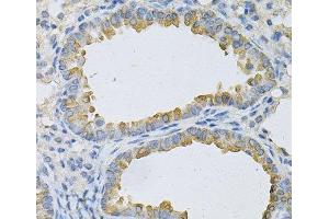Immunohistochemistry of paraffin-embedded Mouse lung using AP2B1 Polyclonal Antibody at dilution of 1:100 (40x lens). (AP2B1 抗体)