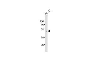 Anti-PIP4K2A Antibody (C-term)at 1:1000 dilution + PC-12 whole cell lysates Lysates/proteins at 20 μg per lane. (PIP4K2A 抗体  (C-Term))