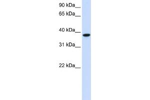 WB Suggested Anti-GLT8D2 Antibody Titration:  0. (GLT8D2 抗体  (C-Term))
