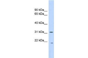 WB Suggested Anti-CAPNS1 Antibody Titration: 0. (Calpain S1 抗体  (Middle Region))