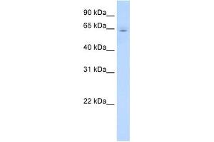 CYP2E1 antibody used at 1 ug/ml to detect target protein. (CYP2E1 抗体  (C-Term))