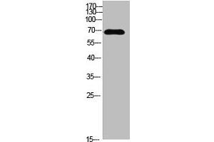 Western blot analysis of MCF7 SW480 MOUSE-LIVER mouse-lung MOUSE-KIDNEY lysate, antibody was diluted at 500. (IL16 抗体  (AA 900-960))