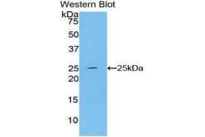Western blot analysis of the recombinant protein. (ADH1 抗体  (AA 169-370))