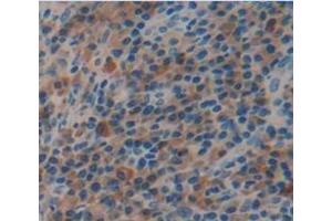 IHC-P analysis of Human Tissue, with DAB staining. (FBLN4 抗体  (AA 17-169))