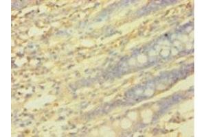 Immunohistochemistry (IHC) image for anti-Protein Interacting With Protein Kinase C, alpha 1 (PICK1) (AA 1-200) antibody (ABIN7164283)