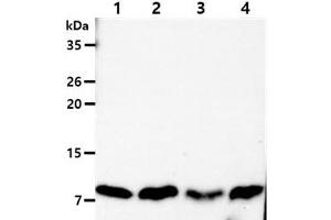 The Cell lysates (40ug) were resolved by SDS-PAGE, transferred to PVDF membrane and probed with anti-human DYNLL antibody (1:1000). (DYNLL1 抗体)