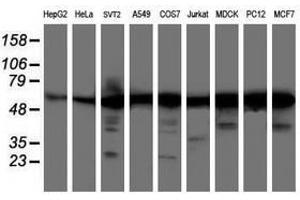 Image no. 1 for anti-V-Akt Murine Thymoma Viral Oncogene Homolog 1 (AKT1) antibody (ABIN1496558) (AKT1 抗体)