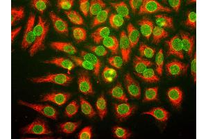 HeLa cells were stained with anti-nuclear pore complex antibody (green), and chicken anti-vimentin (red). (Nuclear Stain of Multiple Gene Products Including Nup62, Nup133 抗体)