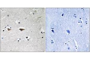 Immunohistochemistry analysis of paraffin-embedded human brain tissue, using Src (Ab-75) Antibody. (Src 抗体  (AA 41-90))