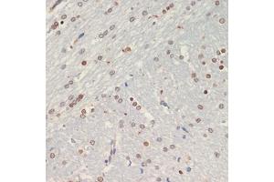 Immunohistochemistry of paraffin-embedded rat brain using Olig2 antibody (ABIN6128396, ABIN6145015, ABIN6145016 and ABIN6216575) at dilution of 1:200 (40x lens). (OLIG2 抗体  (AA 1-80))