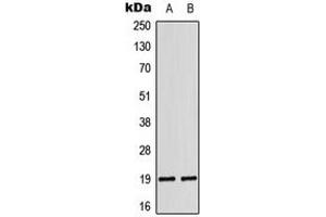 Western blot analysis of LATH expression in DU145 (A), K562 (B) whole cell lysates.