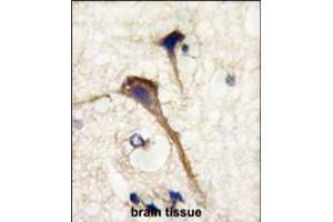 Formalin-fixed and paraffin-embedded human brain tissue reacted with INA antibody , which was peroxidase-conjugated to the secondary antibody, followed by DAB staining. (INA 抗体  (AA 290-319))