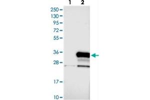Western blot analysis of Lane 1: Negative control (vector only transfected HEK293T lysate), Lane 2: Over-expression Lysate (Co-expressed with a C-terminal myc-DDK tag (~3. (N4BP2L1 抗体)