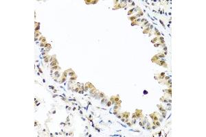 Immunohistochemistry of paraffin-embedded mouse lung using TET2 antibody (ABIN6133019, ABIN6149017, ABIN6149019 and ABIN6221336) at dilution of 1:100 (40x lens). (TET2 抗体  (AA 1833-2002))