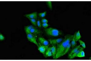 Immunofluorescent analysis of Hela cells using ABIN7168489 at dilution of 1:100 and Alexa Fluor 488-congugated AffiniPure Goat Anti-Rabbit IgG(H+L) (RUNX3 抗体  (AA 1-415))