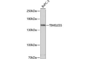 Western blot analysis of extracts of BxPC-3 cells, using TIMELESS antibody (ABIN1683038, ABIN3018743, ABIN3018744 and ABIN6220565) at 1:3000 dilution. (TIMELESS 抗体  (AA 969-1208))