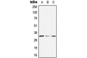Western blot analysis of GTF2E2 expression in HeLa (A), SP2/0 (B), H9C2 (C) whole cell lysates.