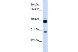 WB Suggested Anti-FLT3LG Antibody Titration:  0. (FLT3LG 抗体  (N-Term))