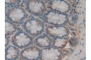 Detection of LPO in Rat Stomach Tissue using Polyclonal Antibody to Lactoperoxidase (LPO) (LPO 抗体  (AA 351-589))