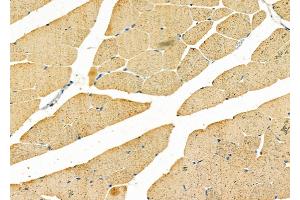 ABIN6258893 and ABIN6275754 at 1/100 staining Mouse muscle tissue by IHC-P. (GNE 抗体  (C-Term))