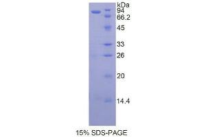 SDS-PAGE analysis of Human HSP90aB1 Protein. (Heat Shock Protein 90kDa alpha B1 蛋白)