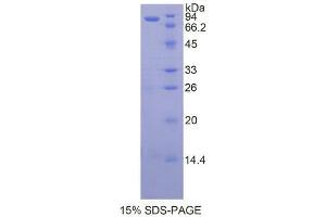 Heat Shock Protein 90kDa alpha B1 protein