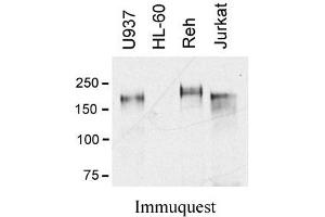 Image no. 1 for anti-C-Mer Proto-Oncogene Tyrosine Kinase (MERTK) (Extracellular Domain) antibody (ABIN1169695) (MERTK 抗体  (Extracellular Domain))