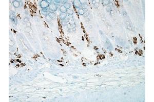 Immunohistochemistry analysis using Mouse Anti-Nitrotyrosine Monoclonal Antibody, Clone 39B6 . (Nitrotyrosine 抗体  (Atto 390))