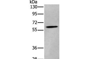 Western blot analysis of Human cerebrum tissue lysate using ZKSCAN1 Polyclonal Antibody at dilution of 1:400 (ZKSCAN1 抗体)