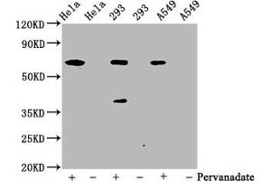 Western Blotting (WB) image for anti-Protein tyrosine Phosphatase, Non-Receptor Type 11 (PTPN11) (pTyr542) antibody (ABIN7127735)